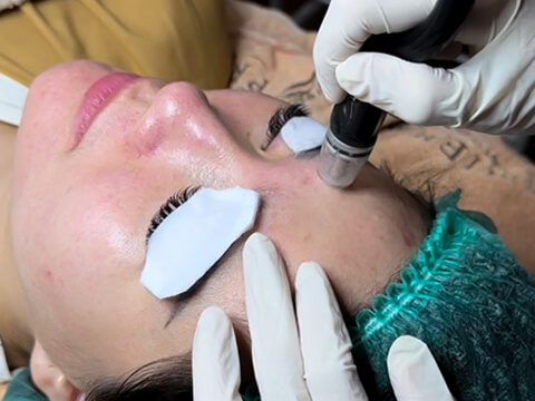 PREMIER SilkPeel DermalInfusion Banner