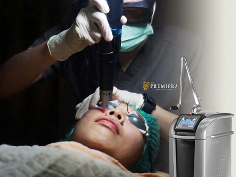 PREMIER True PicoSure PRO Banner