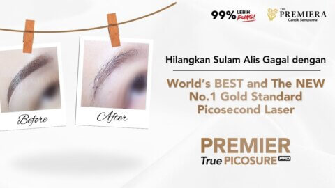 Hilangkan Sulam Alis Gagal dengan World’s BEST and The NEW No.1 Gold Standard Picosecond Laser di PREMIERA Thumbnail